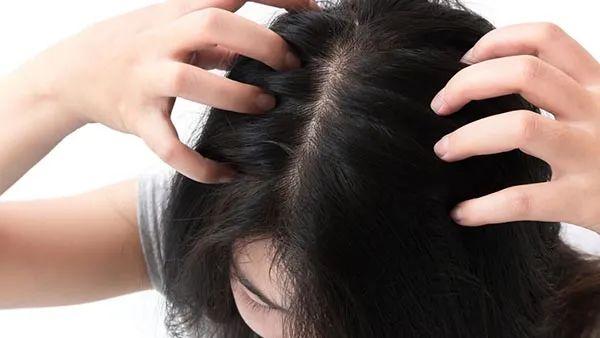 如何治疗脱发和掉发的相关图片